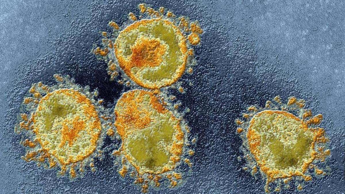 Вологжане распространяют ложь о коронавирусе