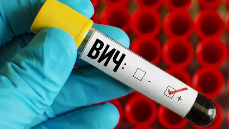 В Череповце женщина заразила ВИЧ-инфекцией троих мужчин